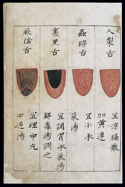 chinese_tongue_diagnosis_chart.jpg
